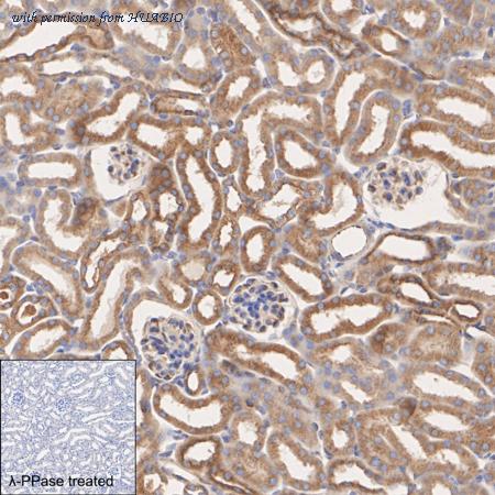 HUABIO ET1610-29 image 3