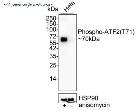 HUABIO ET1610-30 image 1