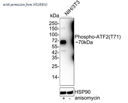 HUABIO ET1610-30 image 2
