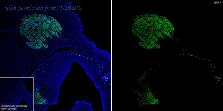 HUABIO ET1610-33 image 2