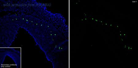 HUABIO ET1610-33 image 3