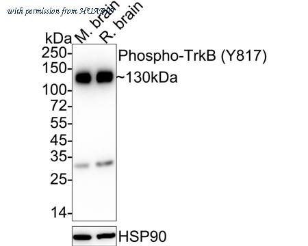 HUABIO ET1610-35-50UL image 1