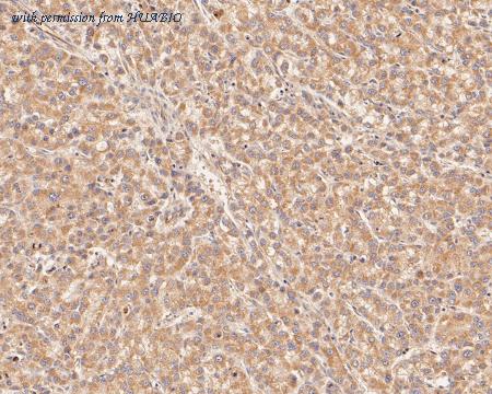 HUABIO ET1610-36 image 3