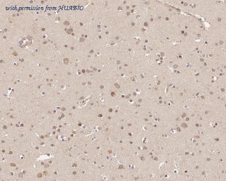 HUABIO ET1610-37-50UL image 3