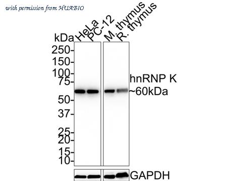HUABIO ET1610-38 image 1