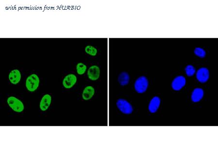 HUABIO ET1610-38 image 3