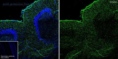 HUABIO ET1610-39 image 1