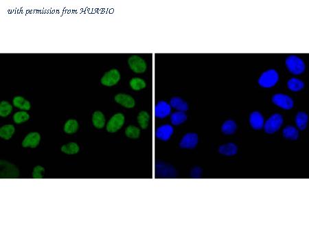 HUABIO ET1610-40 image 2