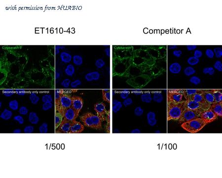 HUABIO ET1610-43 image 1