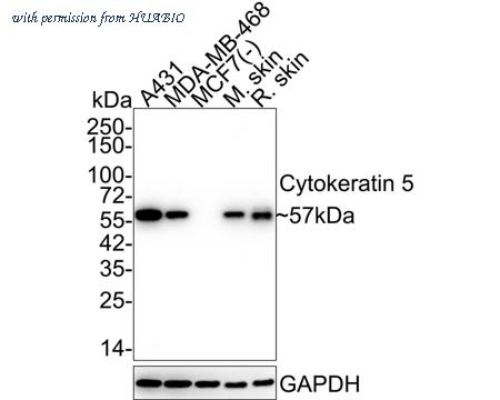 HUABIO ET1610-43 image 2
