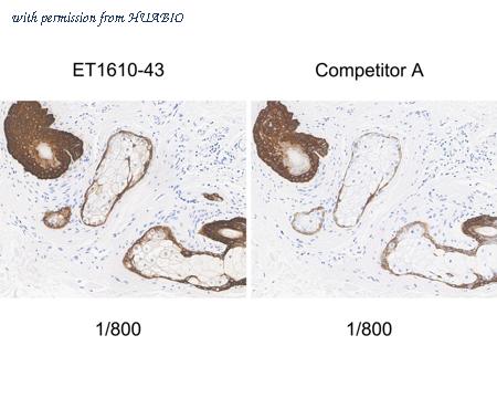 HUABIO ET1610-43 image 3