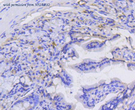 HUABIO ET1610-46 image 2