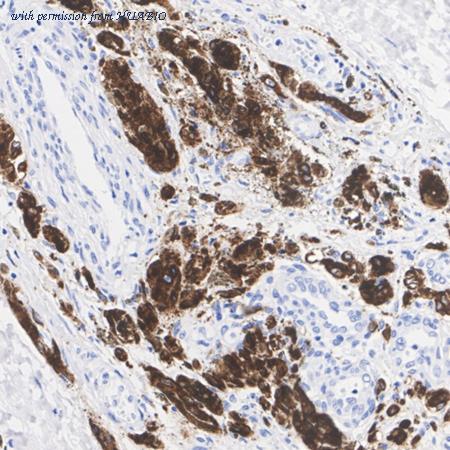 HUABIO ET1610-47 image 2