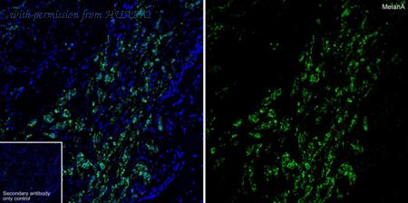 HUABIO ET1610-47 image 3