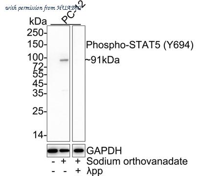 HUABIO ET1610-48 image 1
