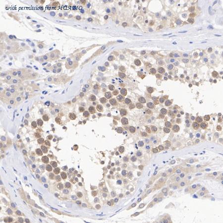 HUABIO ET1610-49 image 2