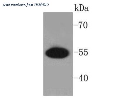 HUABIO ET1610-54 image 1