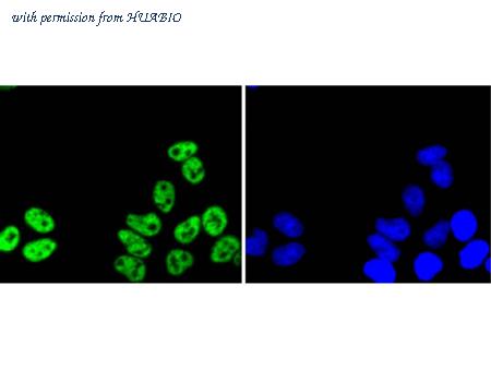HUABIO ET1610-54 image 2