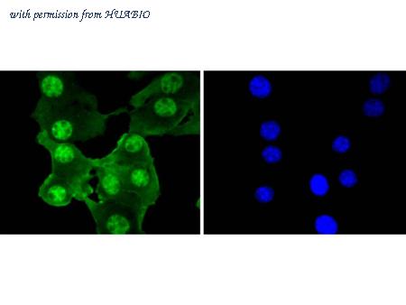 HUABIO ET1610-54 image 3