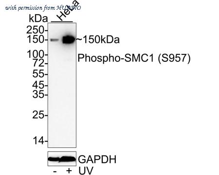 HUABIO ET1610-55 image 1