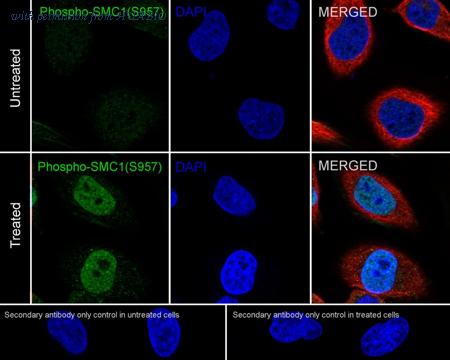 HUABIO ET1610-55 image 2