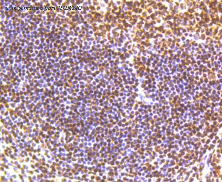 HUABIO ET1610-55 image 3