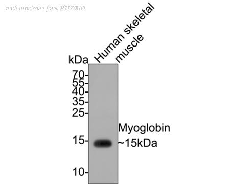 HUABIO ET1610-56 image 2