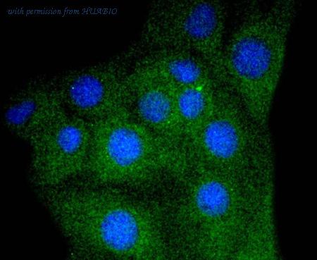 HUABIO ET1610-56 image 3