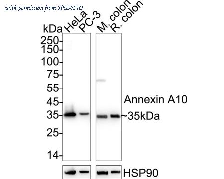 HUABIO ET1610-57 image 1