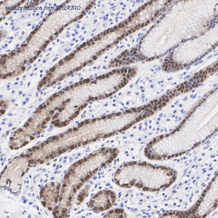 HUABIO ET1610-57 image 2