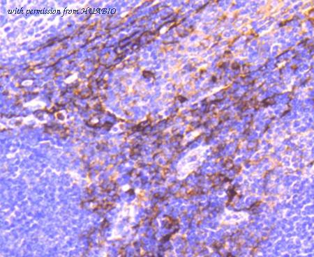 HUABIO ET1610-59 image 3