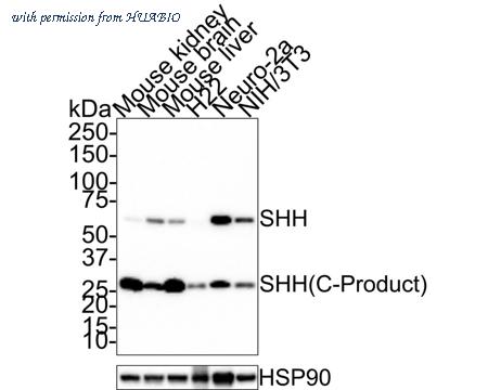HUABIO ET1610-6 image 1