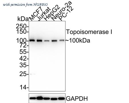 HUABIO ET1610-62-50UL image 1