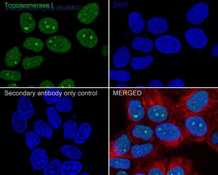 HUABIO ET1610-62-50UL image 2