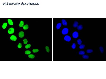 HUABIO ET1610-62-50UL image 3