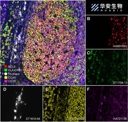 HUABIO ET1610-64 image 1