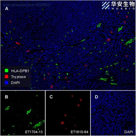 HUABIO ET1610-64 image 3