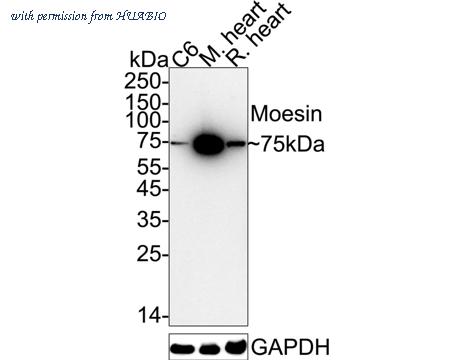 HUABIO ET1610-65 image 1