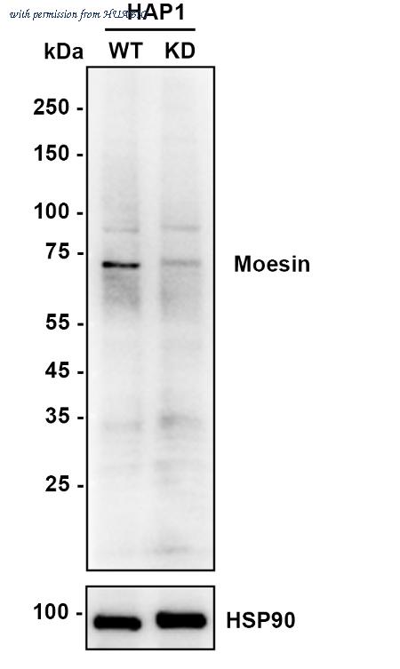 HUABIO ET1610-65 image 2