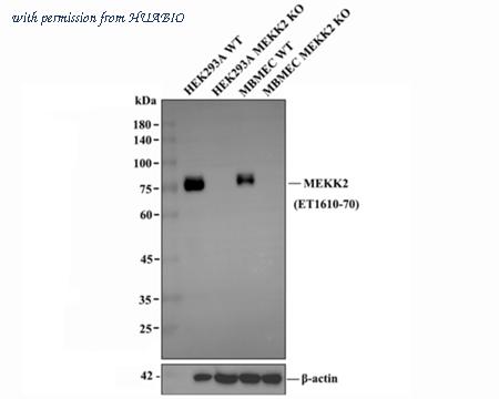 HUABIO ET1610-70 image 1