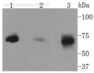 HUABIO ET1610-70 image 2