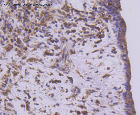 HUABIO ET1610-70 image 3