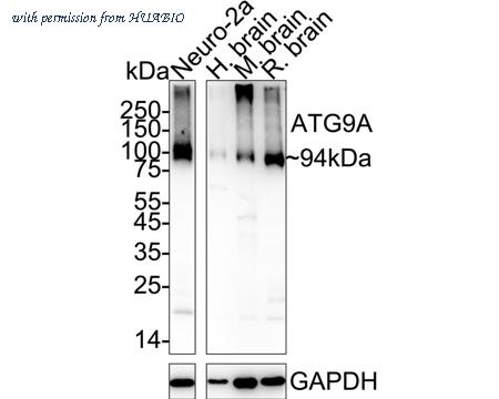 HUABIO ET1610-71 image 2