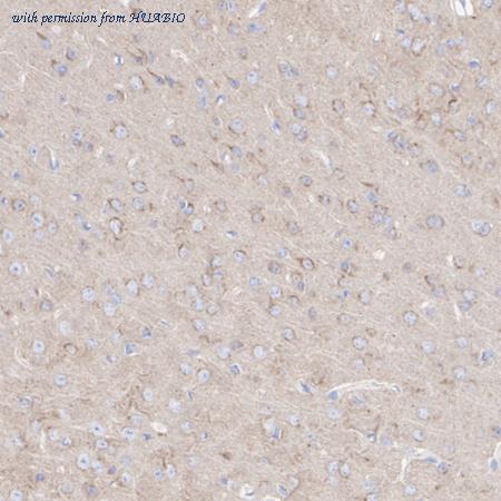 HUABIO ET1610-71 image 3