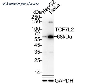 HUABIO ET1610-73 image 1