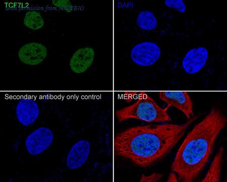 HUABIO ET1610-73 image 2