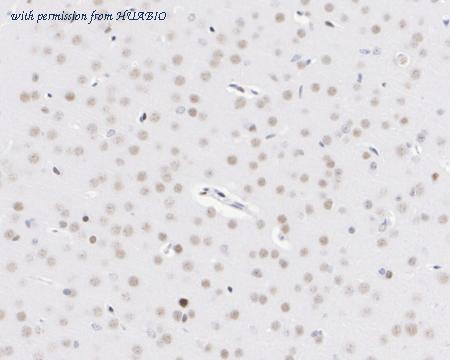 HUABIO ET1610-73 image 3