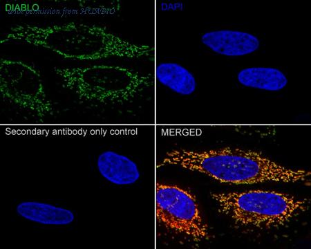 HUABIO ET1610-74 image 2