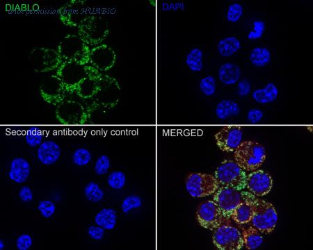 HUABIO ET1610-74 image 3