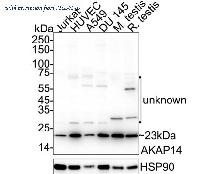 HUABIO ET1610-75 image 1